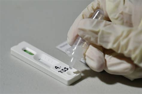 validade teste antigenio